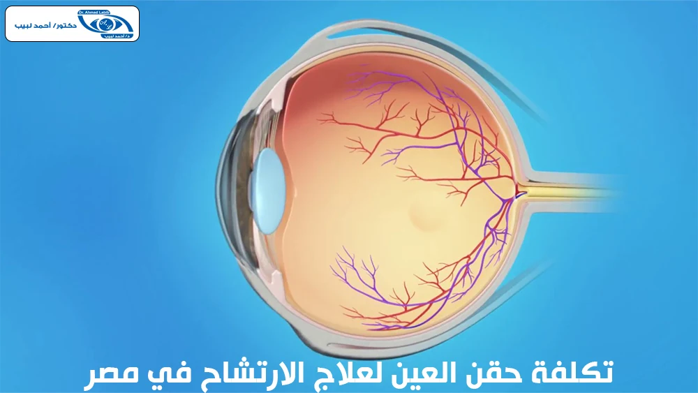 تكلفة حقن العين لعلاج الارتشاح في مصر